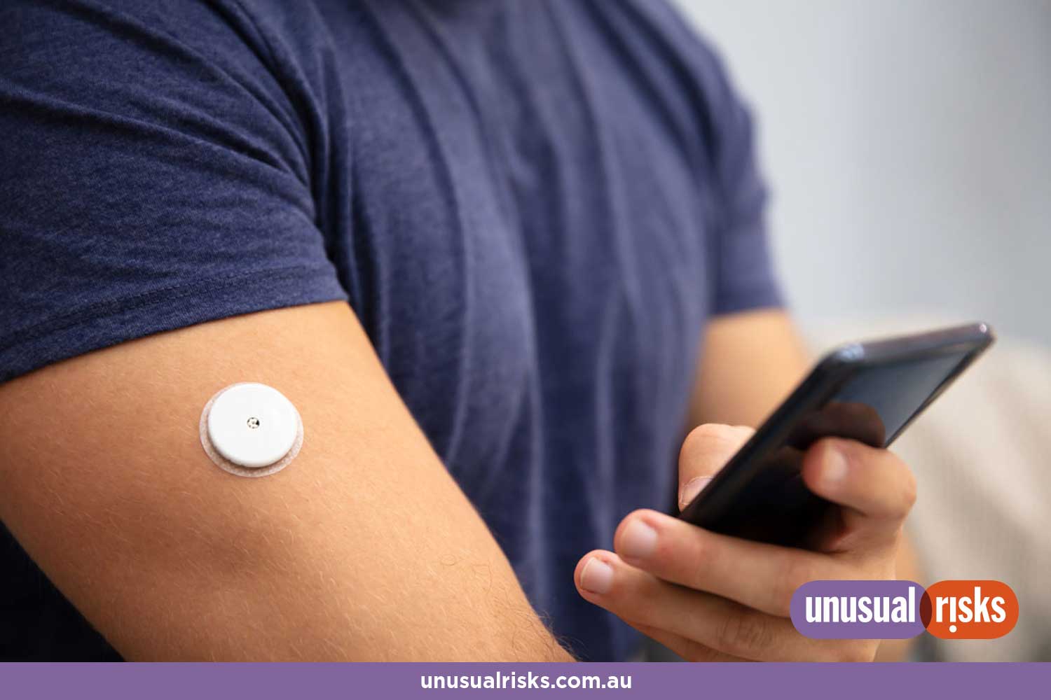 young man wearing an adhesive continuous glucose monitor (CGM) sensor to manage his insulin needs